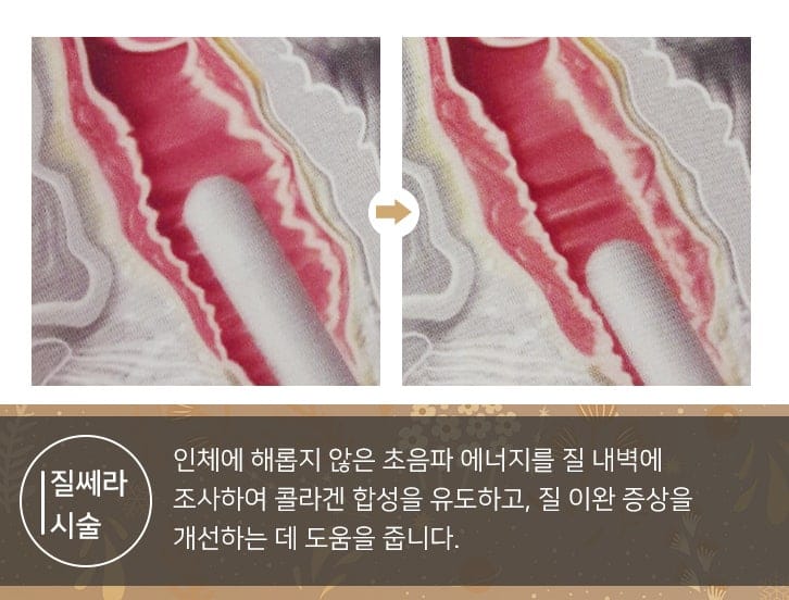 부부 성관계 평균 횟수 관련 이미지 1